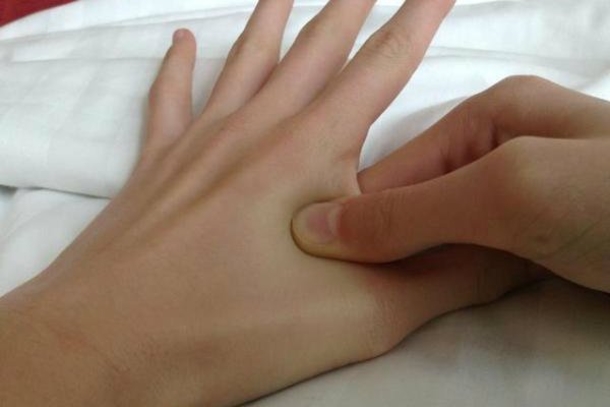 Pressing THESE Points On Your Body, Will Get Rid Of A Headache Immediately Without Medicine! - picture 2