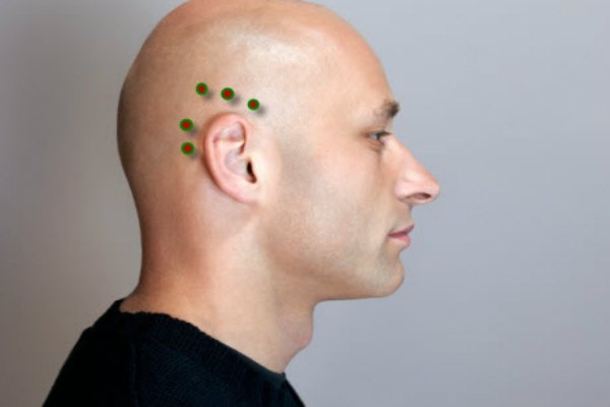 Pressing THESE Points On Your Body, Will Get Rid Of A Headache Immediately Without Medicine! - picture 5