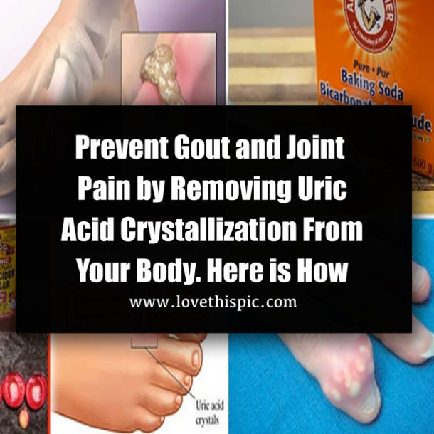 Prevent Gout and Joint Pain by Removing Uric Acid Crystallization From Your Body. Here is How