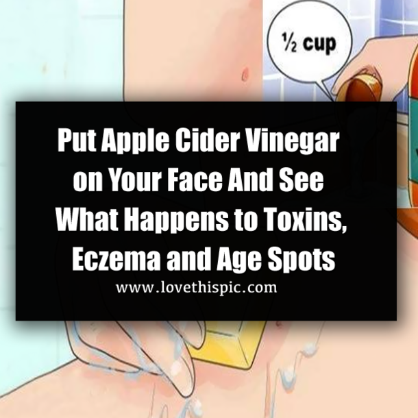 Put Apple Cider Vinegar on Your Face And See What Happens to Toxins, Eczema and Age Spots