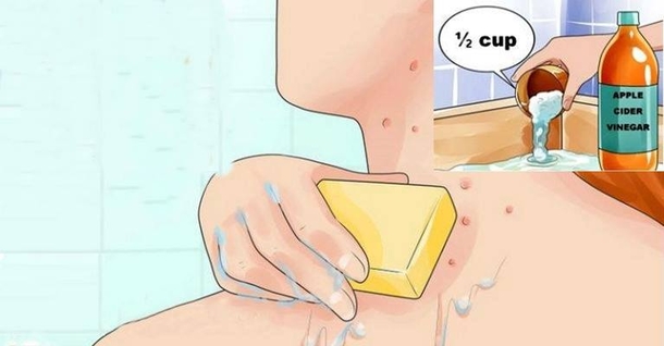 Put Apple Cider Vinegar on Your Face And See What Happens to Toxins, Eczema and Age Spots - picture 2