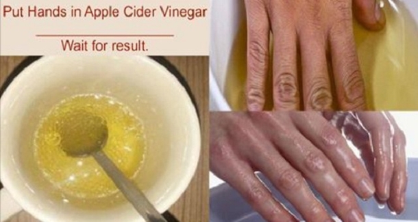 Put Your Hands In Vinegar Two Times A Week And You Will Achieve This... - picture 2