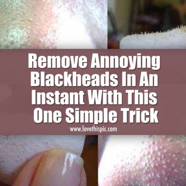 Remove Annoying Blackheads In An Instant With This One Simple Trick
