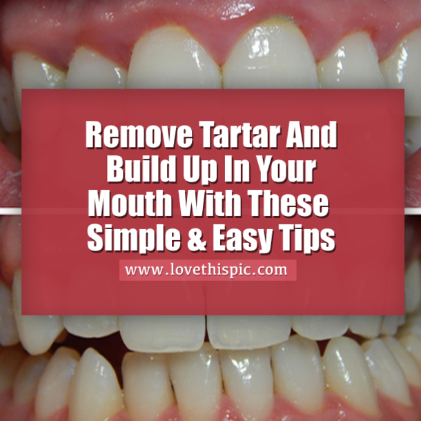 Remove Tartar And Build Up In Your Mouth With These Simple & Easy Tips