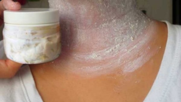 Remove Those Dark Patches On The Neck, Thighs And Inner Arm In Less Than 15 Minutes With THIS... - picture 2
