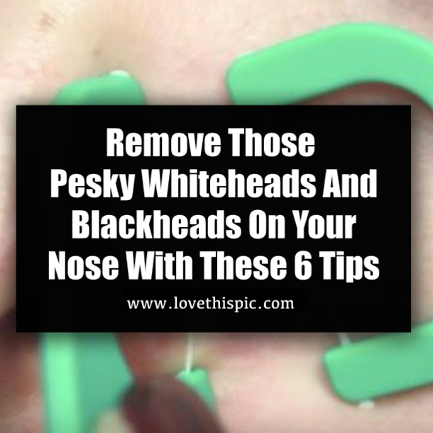 Remove Those Pesky Whiteheads And Blackheads On Your Nose With These 6 Tips