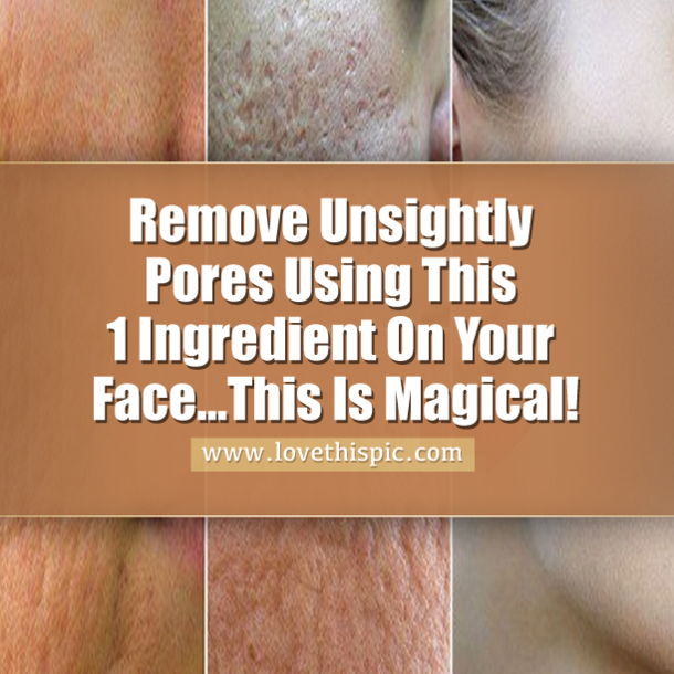 Remove Unsightly Pores Using This 1 Ingredient On Your Face...This Is Magical!
