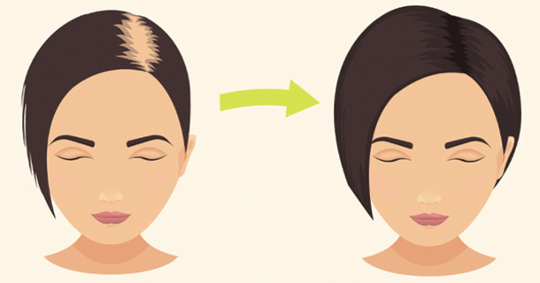Rub This In Your Hair To Stop Hair Loss & Promote Hair Growth! - picture 2