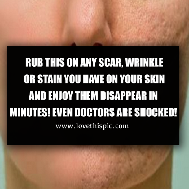 RUB THIS ON ANY SCAR, WRINKLE OR STAIN YOU HAVE ON YOUR SKIN AND ENJOY THEM DISAPPEAR IN MINUTES! EVEN DOCTORS ARE SHOCKED!