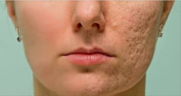 RUB THIS ON ANY SCAR, WRINKLE OR STAIN YOU HAVE ON YOUR SKIN AND ENJOY THEM DISAPPEAR IN MINUTES! EVEN DOCTORS ARE SHOCKED! - picture 2