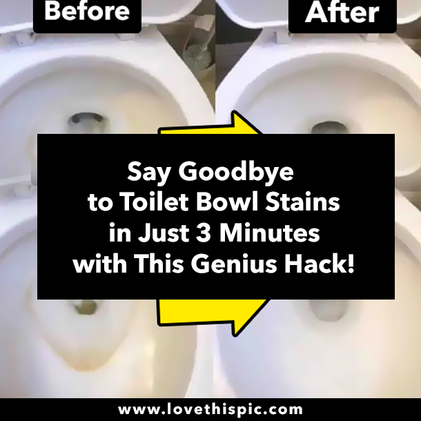 Say Goodbye to Toilet Bowl Stains in Just 3 Minutes with This Genius Hack!