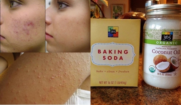 Say Goodbye to Wrinkles and Sagging Facial Skin After Washing It With Coconut Oil and Baking Soda! - picture 2