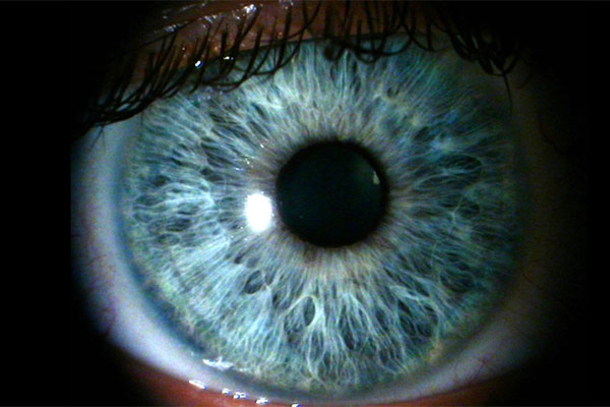 Scientists Say All People With Blue Eyes Have This One Weird Thing In Common. WOW! I Had No Idea! - picture 10