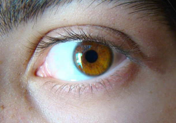 Scientists Say All People With Blue Eyes Have This One Weird Thing In Common. WOW! I Had No Idea! - picture 5