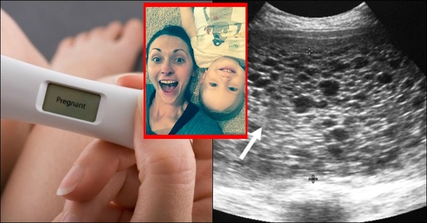 SEE IT: Wife Has Positive Pregnancy Test, But It’s Not A Baby In Her Womb - picture 3
