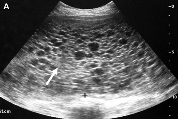 SEE IT: Wife Has Positive Pregnancy Test, But It’s Not A Baby In Her Womb - picture 4