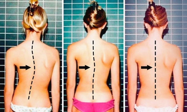 Seven Awesome Exercises That Will Help Give You A Better Spine - picture 2