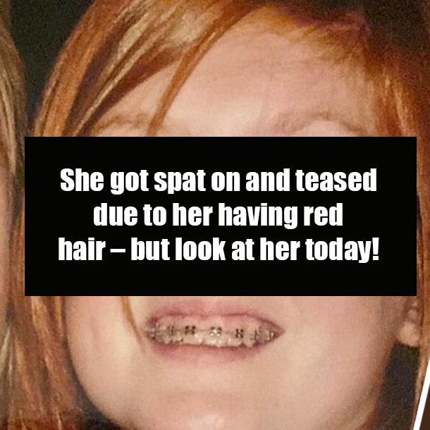 She got spat on due to her having red hair – but look at her today!