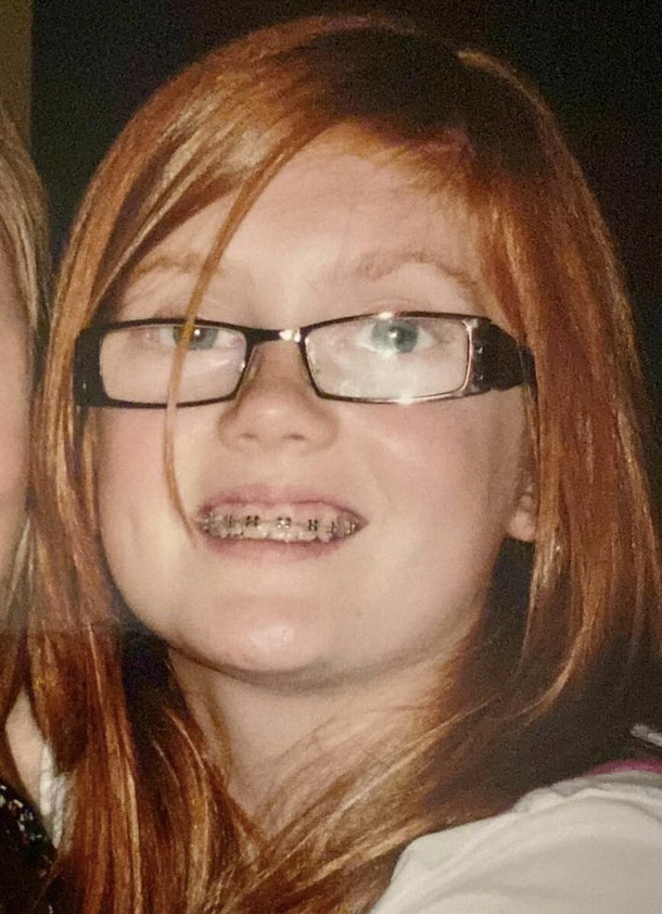 She got spat on due to her having red hair – but look at her today! - picture 2