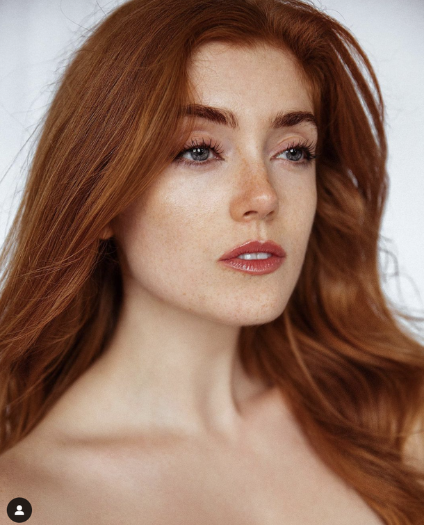 She got spat on due to her having red hair – but look at her today! - picture 5