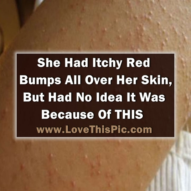 She Had Itchy Red Bumps All Over Her Skin, But Was Shocked When She Found Out It Was Because Of THIS...
