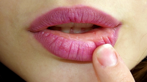 She Put VapoRub On A Cotton Swab And Put It In Her Ear. The Results? Incredible! - picture 9