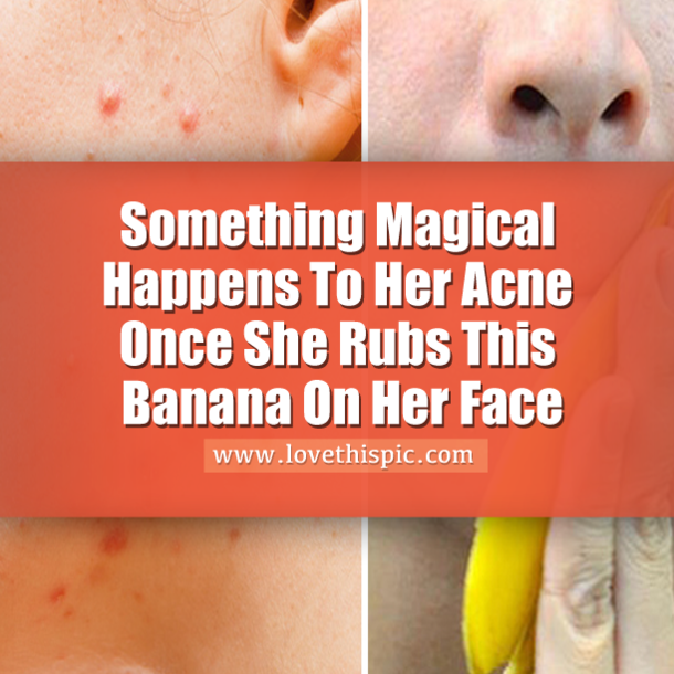 She Rubs This Banana Peel On Her Face And What It Does For Her Skin? AMAZING!