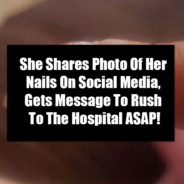 She Shares Photo Of Her Nails On Social Media, Gets Message To Rush To The Hospital ASAP!