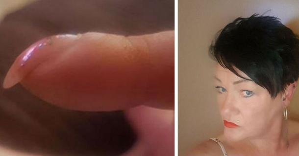 She Shares Photo Of Her Nails On Social Media, Gets Message To Rush To The Hospital ASAP! - picture 2