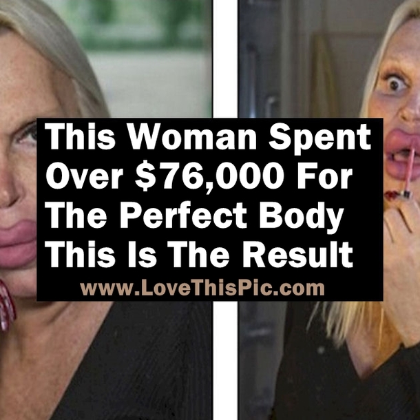 She Spent Over $76,000 For The Perfect Body And Face And This Is The Result...
