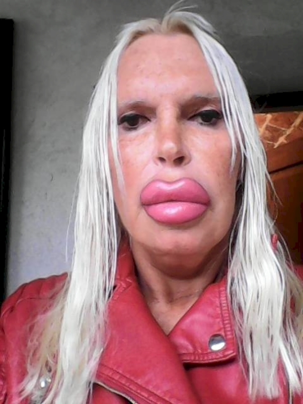 She Spent Over $76,000 For The Perfect Body And Face And This Is The Result... - picture 2