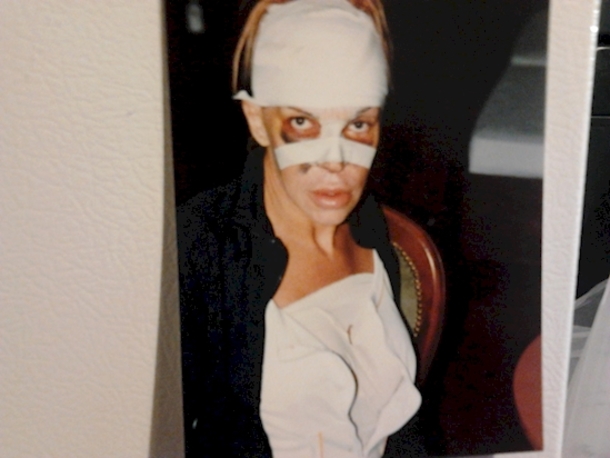 She Spent Over $76,000 For The Perfect Body And Face And This Is The Result... - picture 3