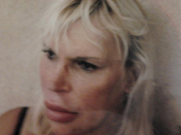 She Spent Over $76,000 For The Perfect Body And Face And This Is The Result... - picture 7