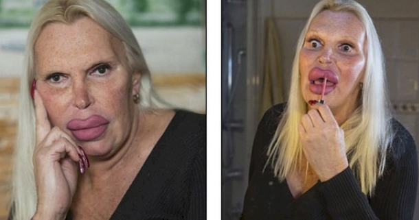 She Spent Over $76,000 For The Perfect Body And Face And This Is The Result... - picture 8