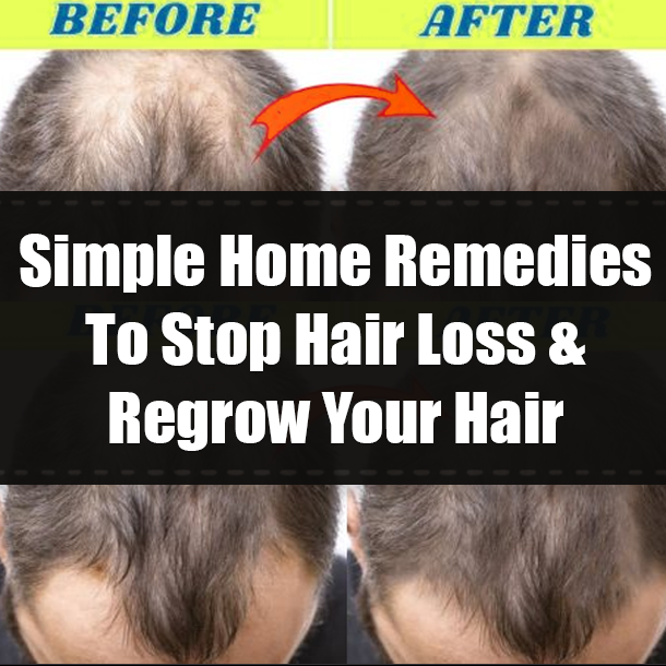 Simple Home Remedies To Stop Hair Loss & Regrow Your Hair