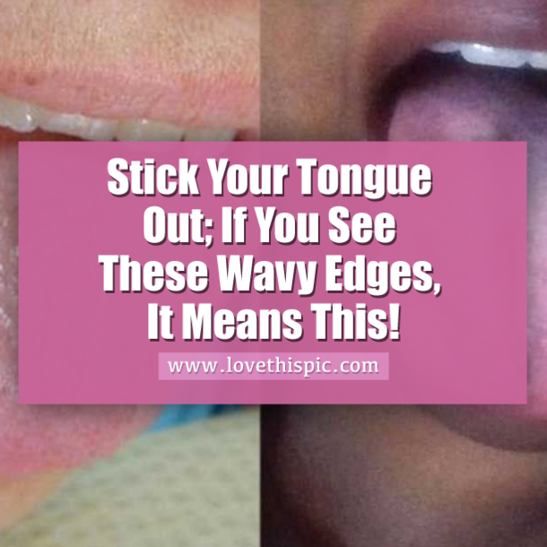 Stick Your Tongue Out; If You See These Wavy Edges, It Means This!