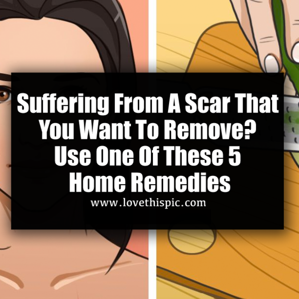 Suffering From A Scar That You Want To Remove?  Use One Of These 5 Home Remedies