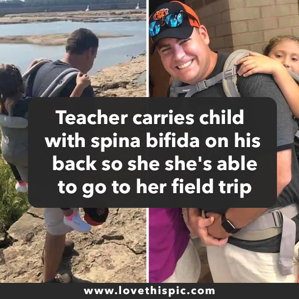 Teacher carries child with spina bifida on his back so she she's able to go to her field trip