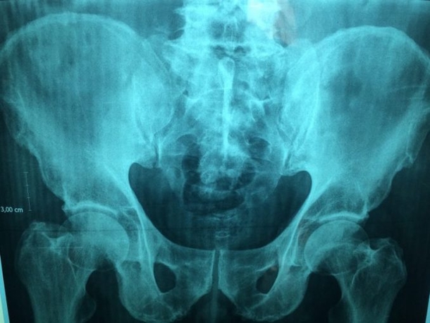 Teen Complains Of Stomach Ache While At School. Two Hours Later, He Was Dead - picture 5