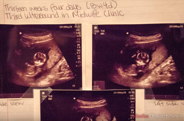 Teen Mom Gives Baby Up For Adoption But Does Something Else That's Making National Headlines - picture 2