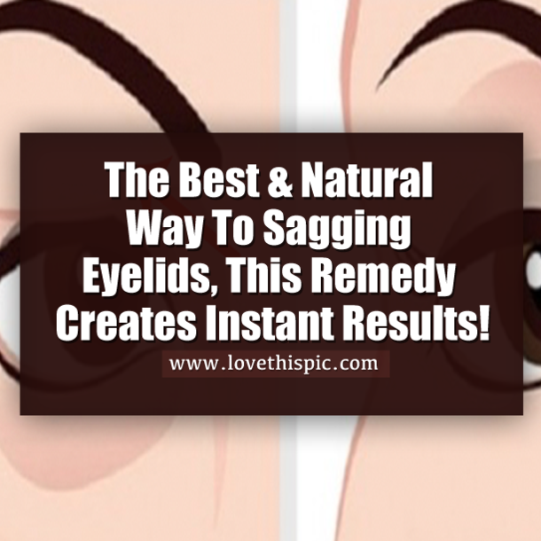 The Best & Natural Way To Sagging Eyelids, This Remedy Creates Instant Results!