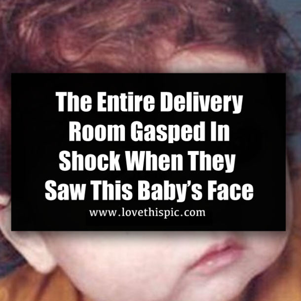 The Entire Delivery Room Gasped In Shock When They Saw This Baby’s Face