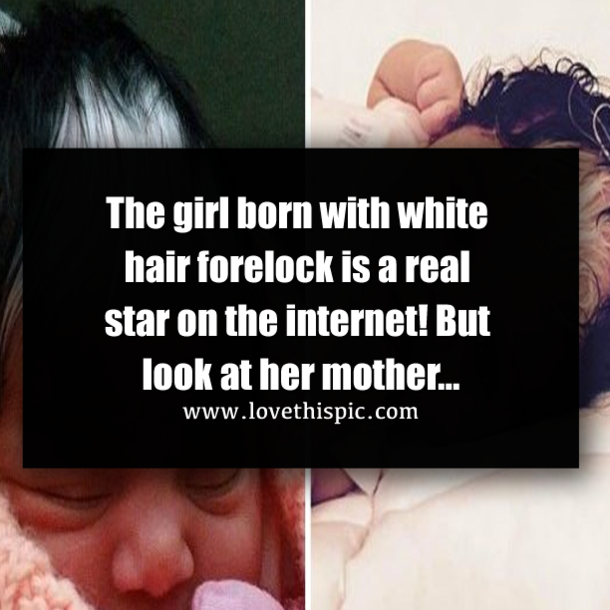 The girl born with white hair forelock is a real star on the internet! But look at her mother…