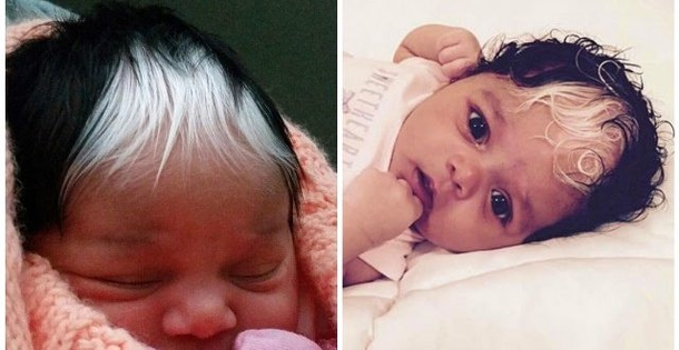 The girl born with white hair forelock is a real star on the internet! But look at her mother… - picture 2