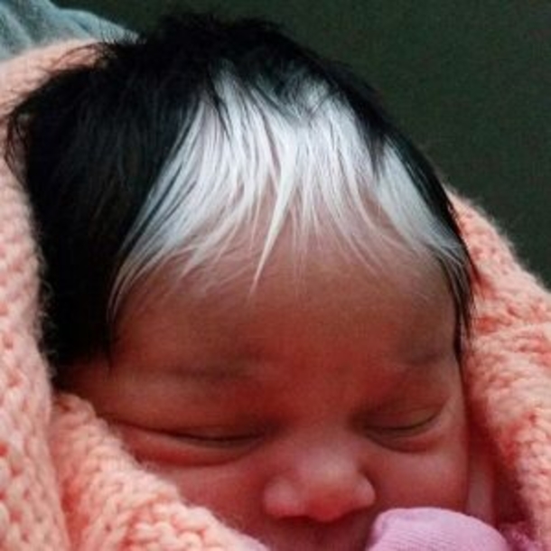 The girl born with white hair forelock is a real star on the internet! But look at her mother… - picture 3
