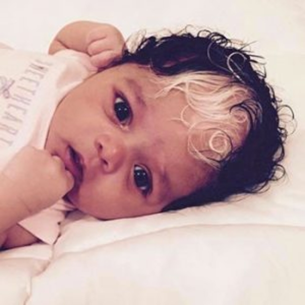 The girl born with white hair forelock is a real star on the internet! But look at her mother… - picture 4