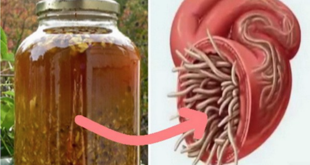 The Most Powerful Natural Antibiotic Ever, It Cures Any Infection In The Body And Kills Parasites! - picture 2