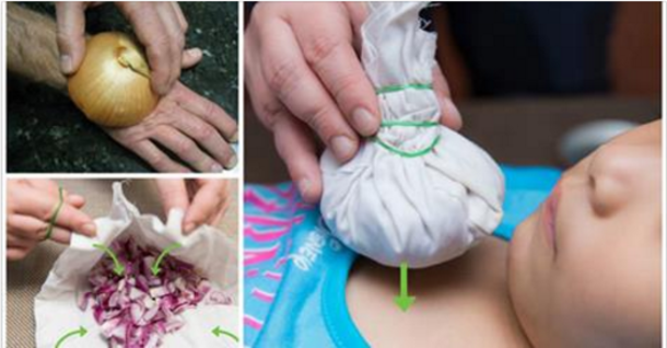 The Power Of Onion: Miraculous & Magical Things You Didn’t Know Onions Could Do! - picture 2