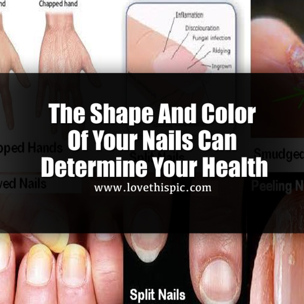 The Shape And Color Of Your Nails Say A Lot About Your Health...
