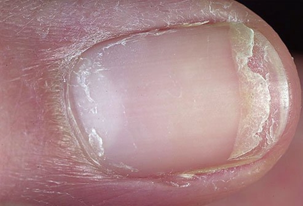 The Shape And Color Of Your Nails Say A Lot About Your Health... - picture 2